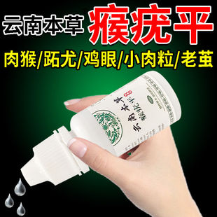 云南本草克疣液去尤瘊小肉粒疣瘊疣猴子清宁疣扁平去除膏抹无忧