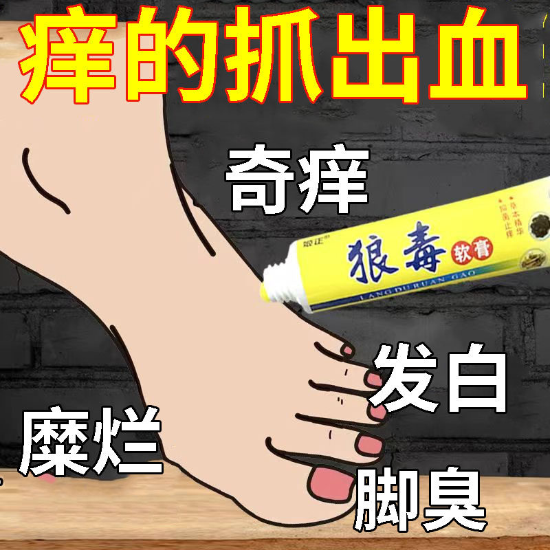 脚痒水泡脱皮烂脚丫脚臭去真菌脚部干燥清爽除臭脚汗膏菌