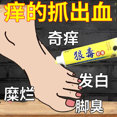脚痒水泡脱皮烂脚丫脚臭去真菌脚部干燥清爽除臭脚汗膏菌