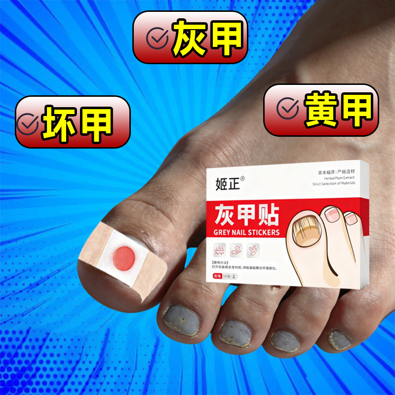 贴正品植物萃取脚趾手指甲通用