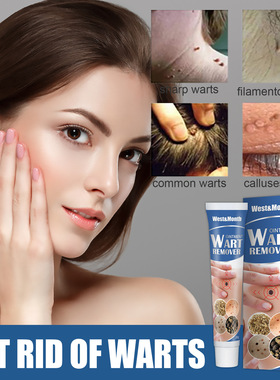 Wart Treatment Ointment Remover Cream Skin Tag Treatment Her