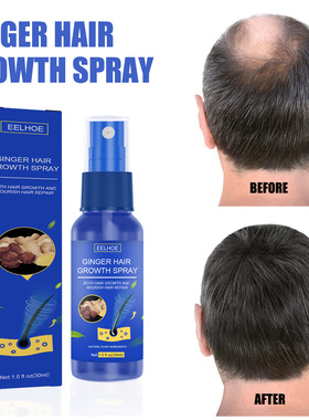 EELHOEGinger Hair Growth Serum Spray Anti Hair Loss Regrowth
