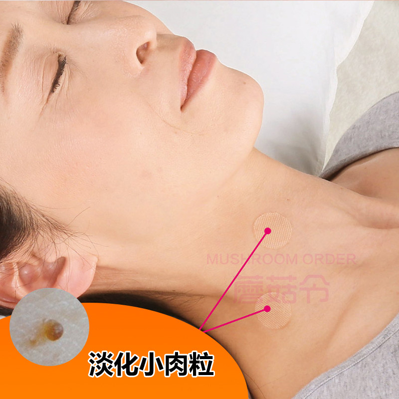 日本脸部脖子腋下淡化小肉粒疙瘩肉栓猴子皮赘贴精华夜间修护
