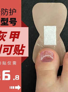 治疗专用灰指甲创可贴防护脚趾