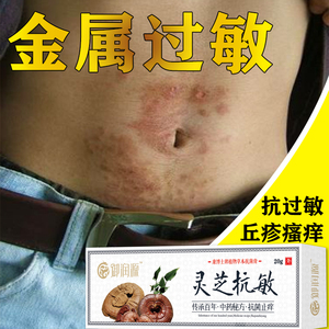 金属过敏皮肤瘙痒止痒膏