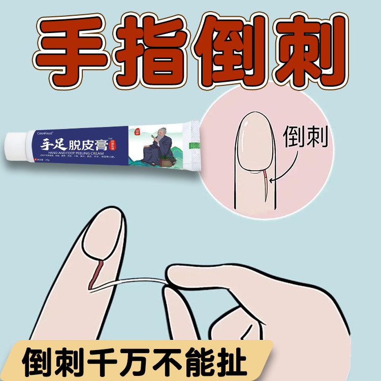 手足脱皮膏手指倒刺修复儿童指甲边缘干裂手上长肉刺防倒刺修护霜