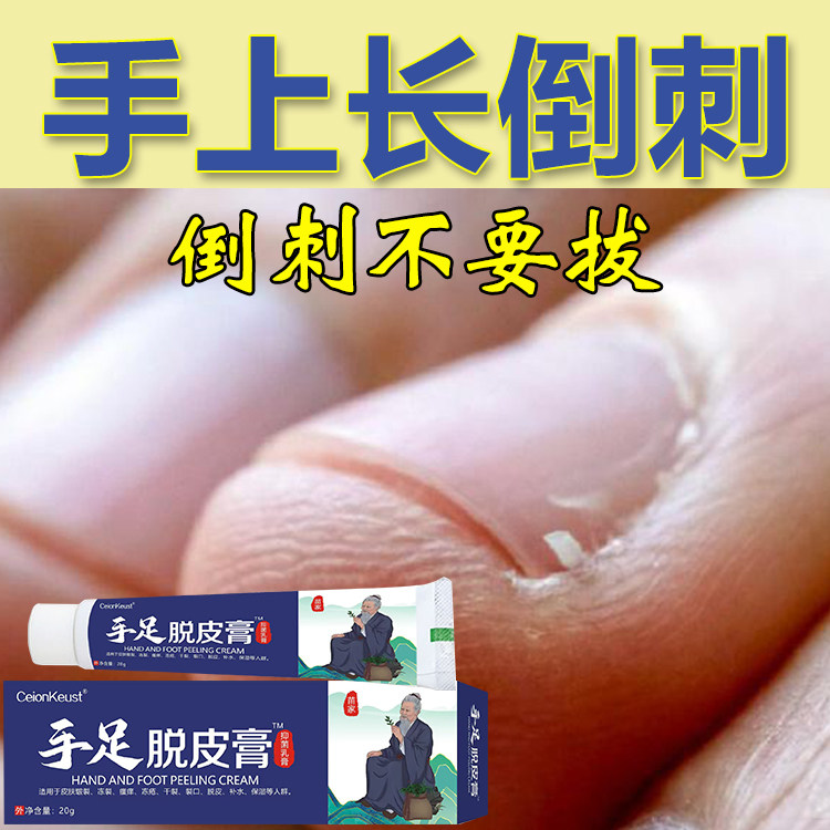手足脱皮膏手指倒刺修复儿童指甲边缘干裂手上长肉刺防倒刺修护霜