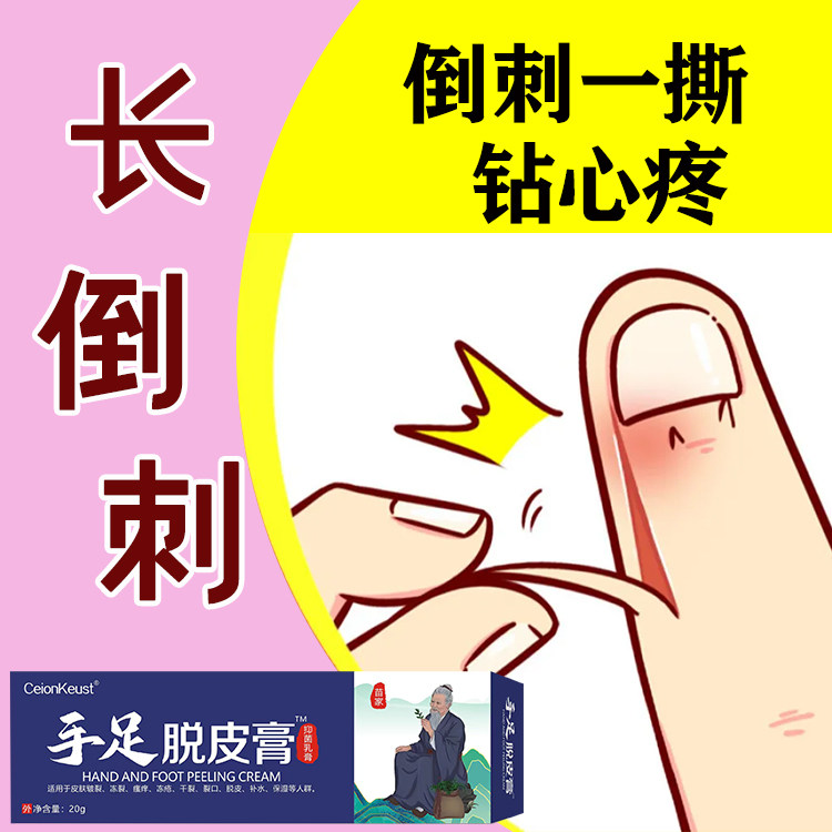 手足脱皮膏手指倒刺修复学生指甲边缘干裂手上起皮防倒刺修护儿童