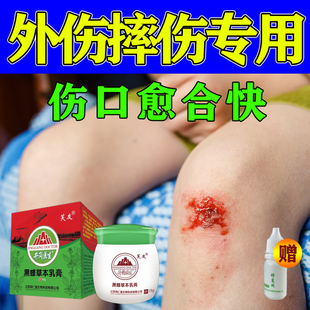 儿童摔伤破皮药膝盖擦伤磕伤腿脚破皮促外伤快速结痂愈合软膏