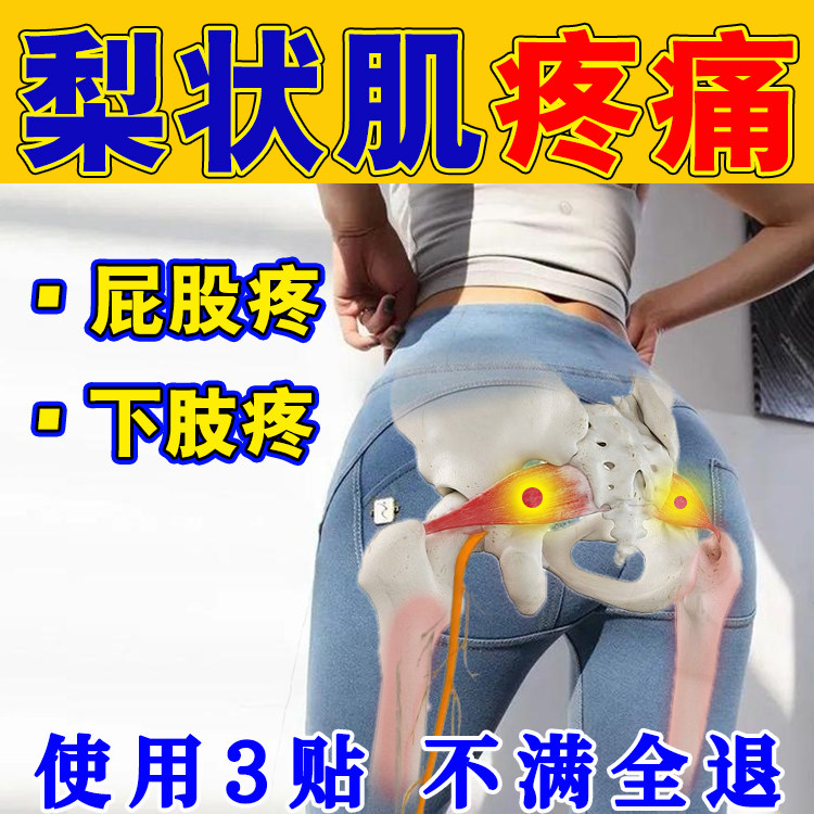 梨状肌综合症屁股疼膏药贴梨状肌疼痛压迫臀部大小腿疼下肢疼麻木