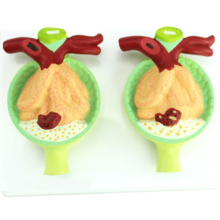 医学蛋白尿模型人体肾脏模型肾小体解剖泌尿内科