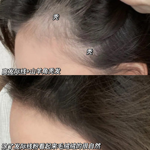 发际线粉防水防汗遮盖粉阴影自然修容填充神器补发缝修饰