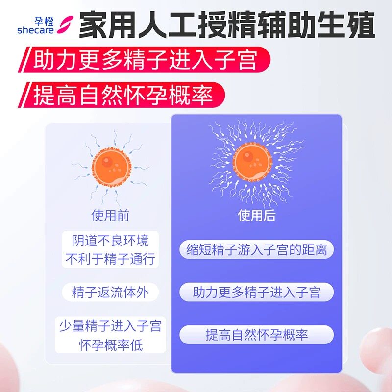 人工授精自精助孕家里自动怀孕技术指导 帮助少花冤枉钱