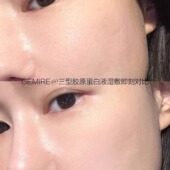 反馈口碑见证实力 三型胶原蛋白液 好评不断