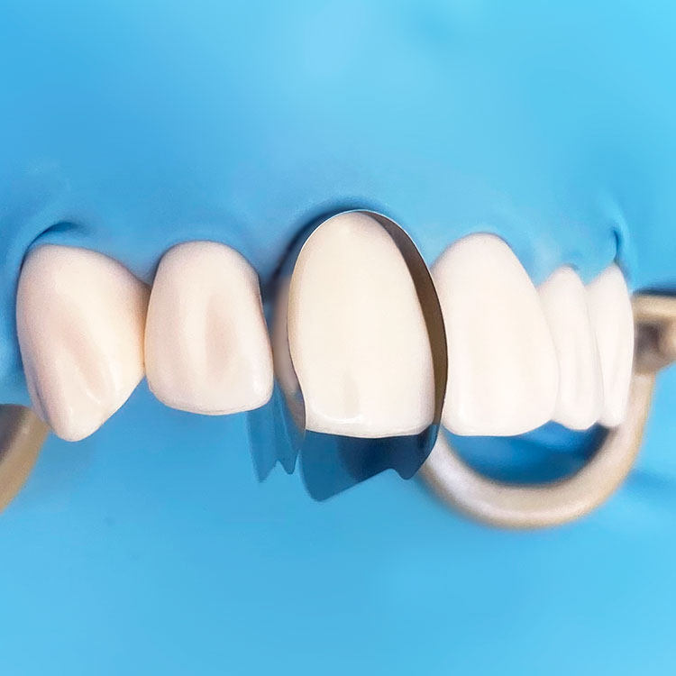 Dentpark牙医公园M8前牙金属曲度成形片牙科III和 IV类洞口腔