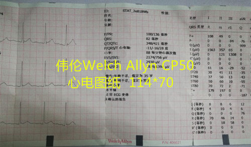 记录纸心电图纸天津广大