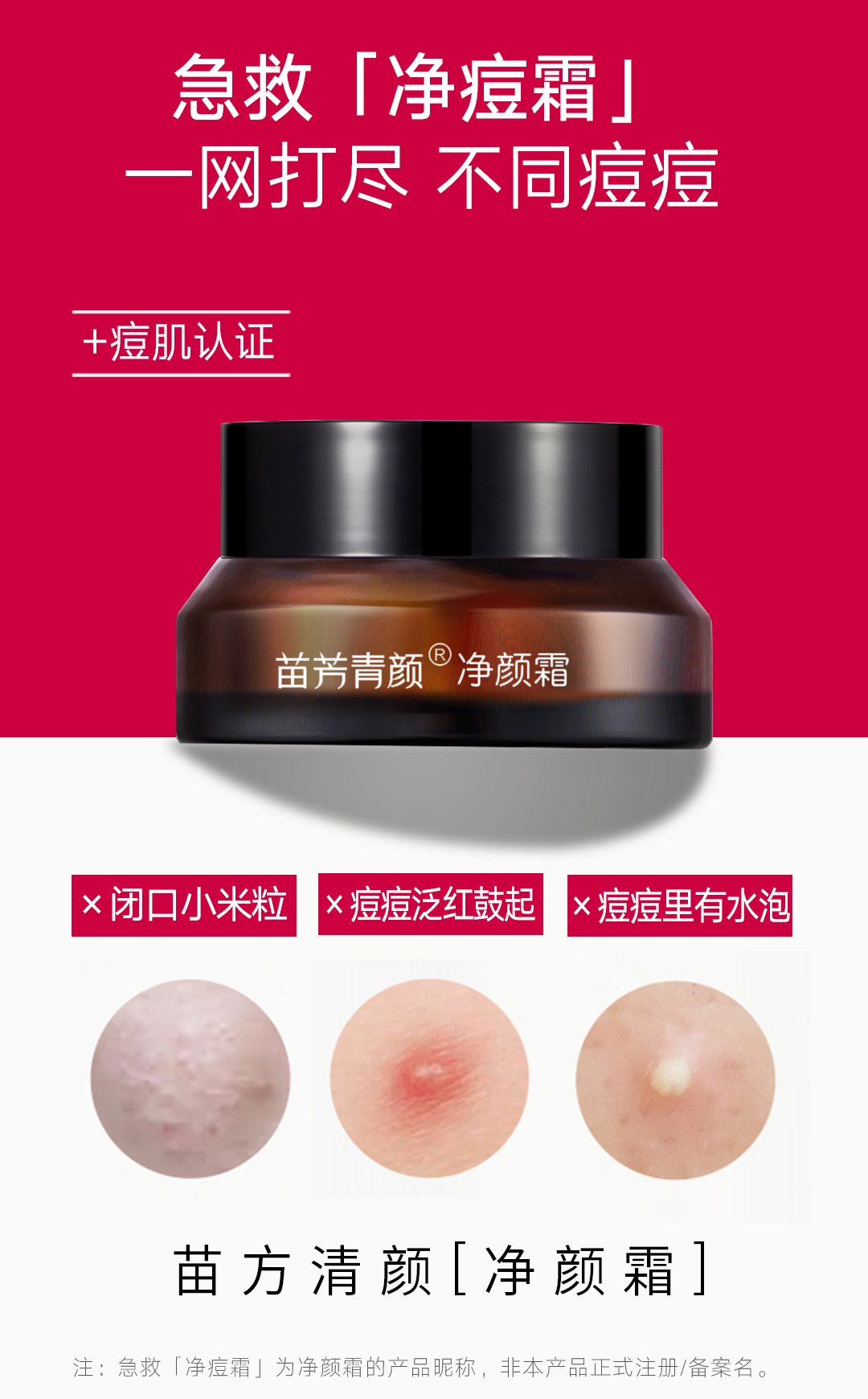 苗方清颜苗芳青颜  净颜霜15g  祛痘印祛痘保湿面霜 正品