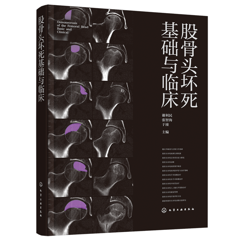 股骨头坏死基础与临床