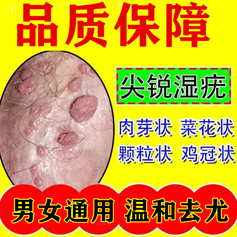竹叶草脂10ml足叶草脂涂剂欧化私处竹叶草脂鬼臼毒素酊乳膏软