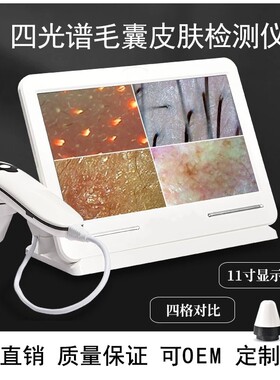 四光谱高清头皮毛囊检测仪