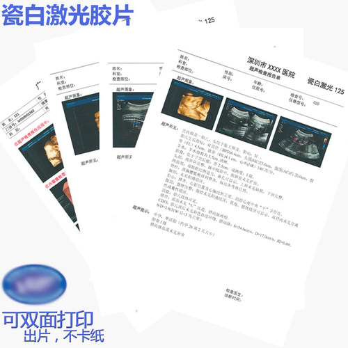 瓷白激光彩色医院用胶片 B超彩超胃镜双面打印 医生用胶片A4 16K