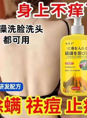 狼毒RQX硫磺沐露浴洗澡祛洗脸洗头三合一清洁痘除杀菌液螨体香皂