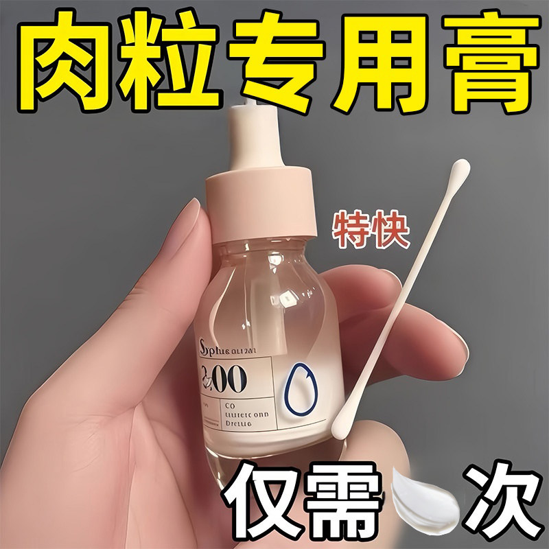 去肉粒皮赘扁平疣瘊子去除膏颈部脖子长小肉粒疙瘩腋下丝状疣肉球