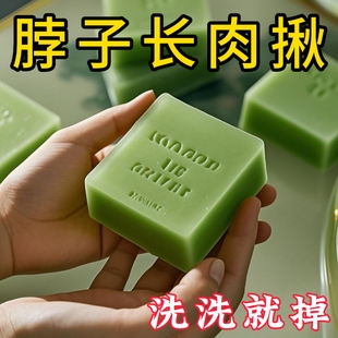 去疣药膏扁平疣去除膏脖子上长小肉粒疙瘩丝状尤瘊子神器一抹无忧