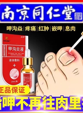 甲沟炎专用液膏消肿软化剂水嵌甲矫正器指甲趾甲去肉芽神器