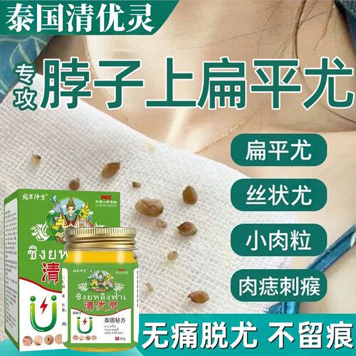 泰国清优灵去尤药膏水尤瘊子小肉粒扁平尤去除膏一抹灵斩草除根