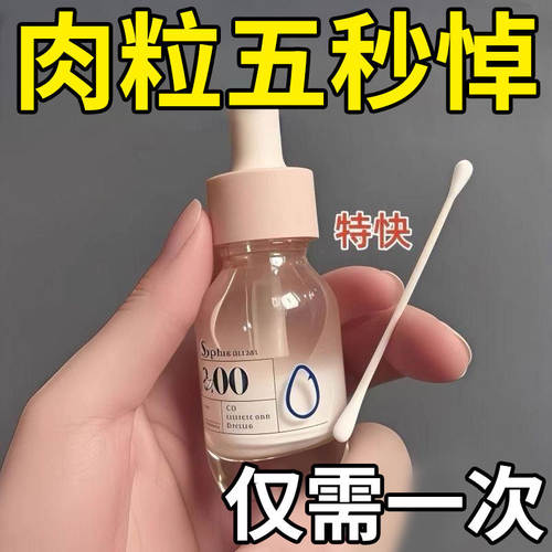 【疣瘊克】扁平疣小肉粒去除软膏