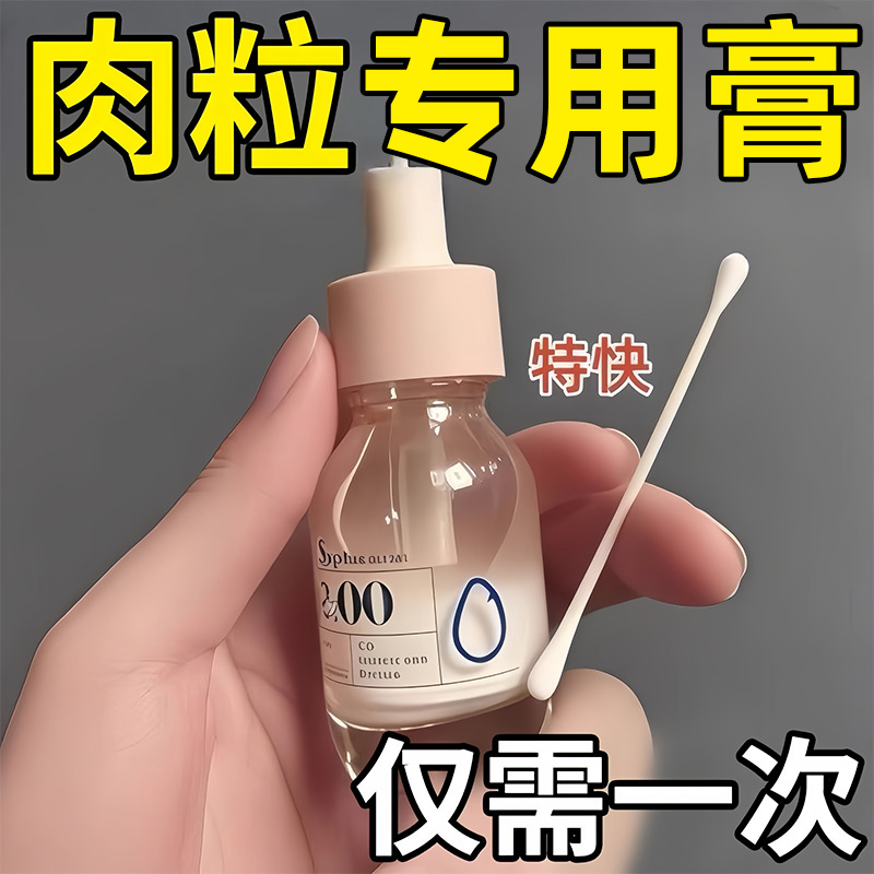 【无痛自然脱落】祛疣瘊肉粒药膏