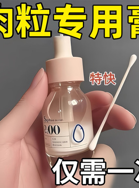 扁平疣去除软膏一抹灵去疣尤瘊用专根斩草除根祛疣小肉粒药膏医用