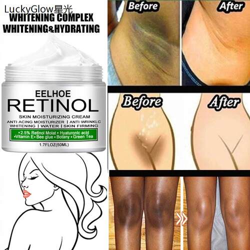 BodyWhitengCreamSkTIm