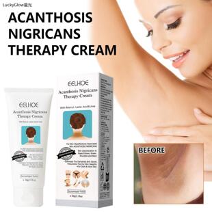 Underarm Whitening Creams For Dark Skin Lightening Body Crot