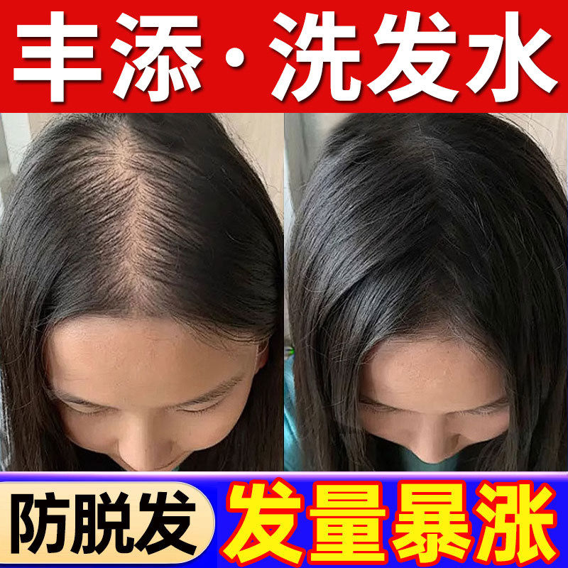 丰添防脱洗发水去屑止痒男士育发蓬松控油胖东来官方店正品