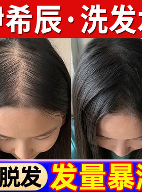 伊希辰洗发水防脱育发侧伯叶生发去屑止痒胖东来官方店正品