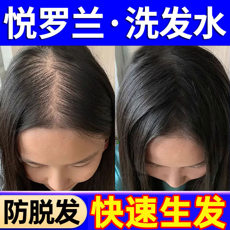 悦罗兰防脱洗发水生发育发控油蓬松去屑止痒侧柏叶正品官方店