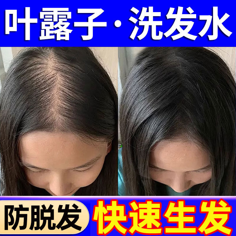 叶露子洗发水防脱育发生发控油蓬松去屑侧柏叶路子正品官方店