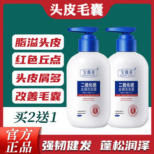 贝璇发舒爽洗发水毛焱清去屑控油止痒洗发液头皮疙瘩贝暶发舒爽