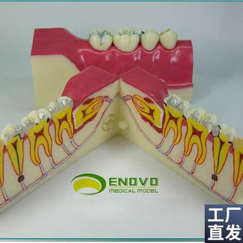 ENOVO颐诺右下后牙r组织分解模型牙齿解剖牙列模型口腔齿科科教学