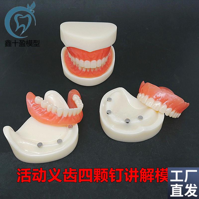 牙科模型活动义齿牙模讲解模型全口义齿四颗钉教学模型.T21包邮