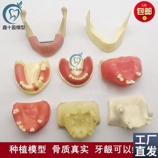 口腔种植练习模型打n孔栽钉种植实操上颌窦提升下颌骨种植练习