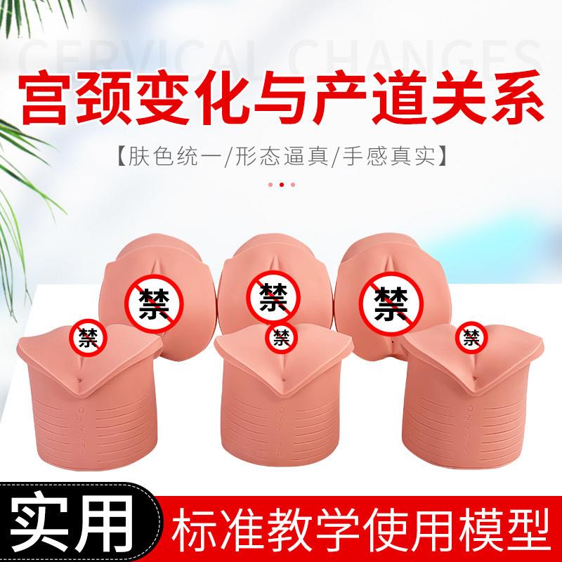 教学模型 女性分娩生产宫口模型 产前宫颈变化与产道关系模型