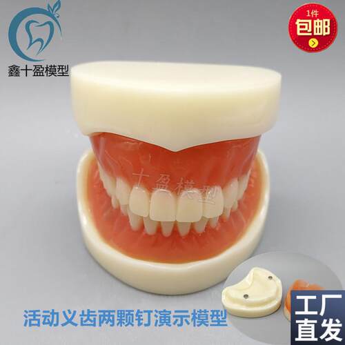 牙科模型活动义齿牙模讲解模型全口义齿两颗N钉教学模型T21包邮