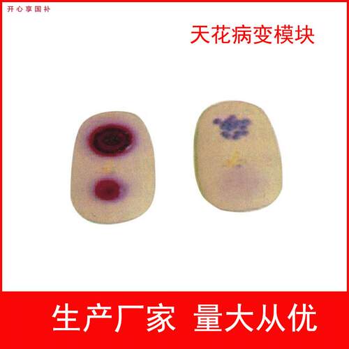天花病变模块护理模型天R花病毒检查模型医学教学模型护士实习用
