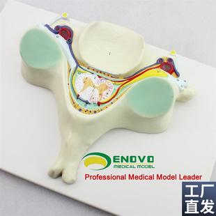 颐诺正品第五颈i椎脊髓和脊神经放大模型脊髓横断解剖颈椎模型