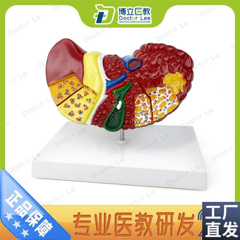 肝脏模型肝脏病理模型肝解剖模型肝K胆胰脾十二指肠消化系统
