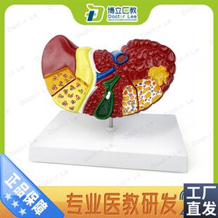 肝脏模型肝脏病理模型肝解剖模型肝K胆胰脾十二指肠消化系统