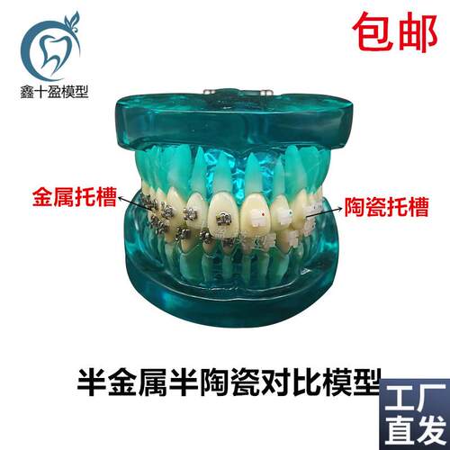 牙科正畸牙模带金属陶瓷托槽牙模型医患沟N通教学口腔牙模型包邮